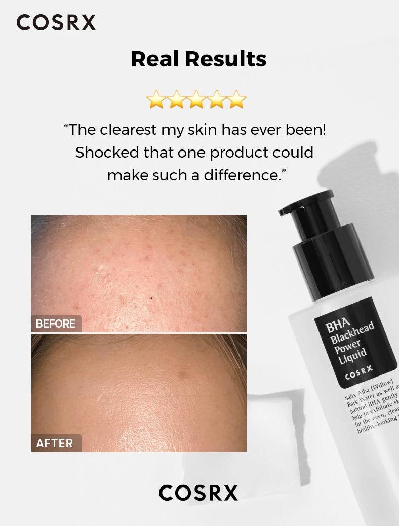 BHA Blackhead Power Liquid Kbeauty Acne Treatment - Asian Skincare Toronto