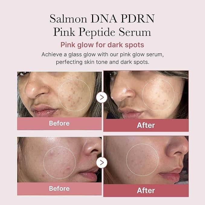 AGE-R Booster Pro EX (Viral & Limited Stock) - Asian Skincare Toronto