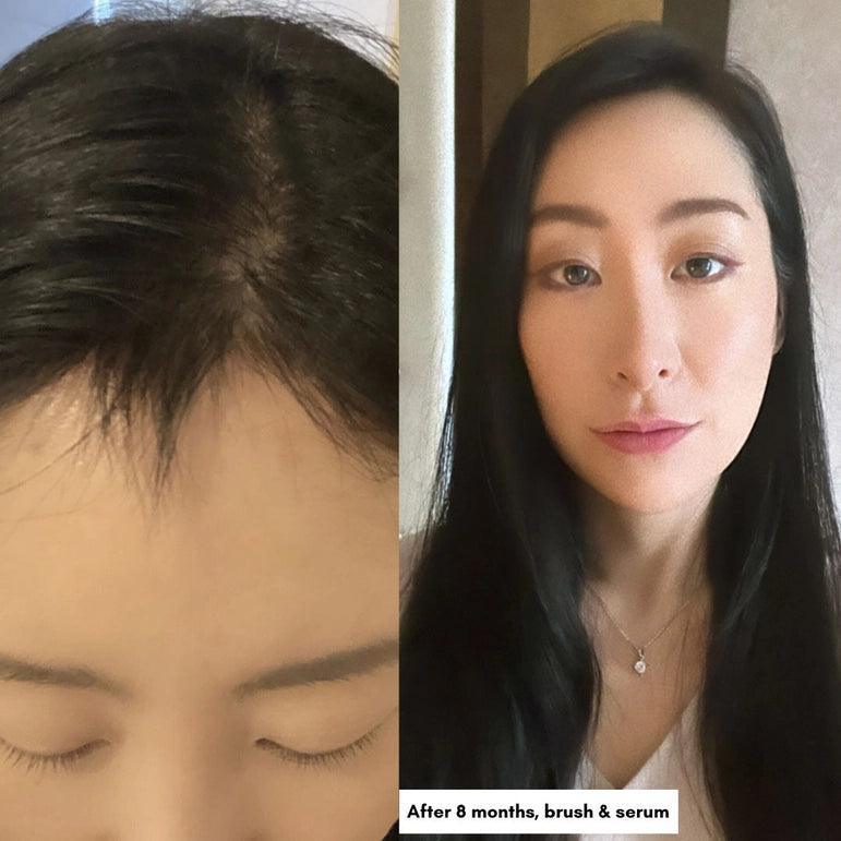 Exclusive Hair Care Bundle for Shiny & Healthy Hair - Asian Skincare Toronto