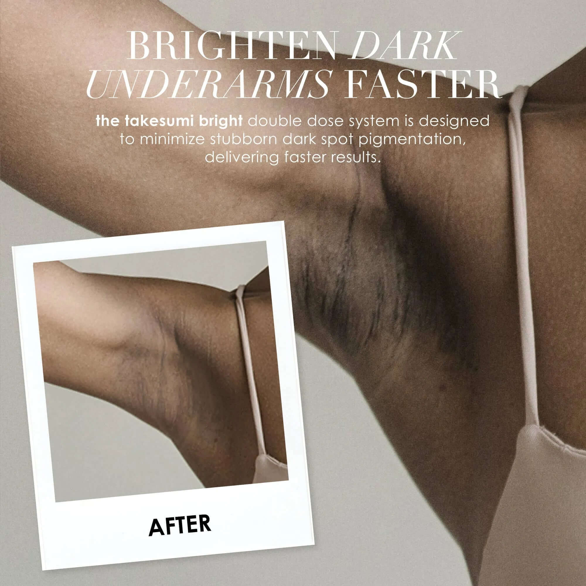 The Brightening Bar | Dark Spot Corrector